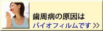 oCItC
